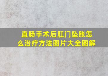 直肠手术后肛门坠胀怎么治疗方法图片大全图解