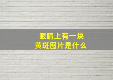 眼睛上有一块黄斑图片是什么