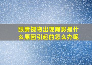 眼睛视物出现黑影是什么原因引起的怎么办呢