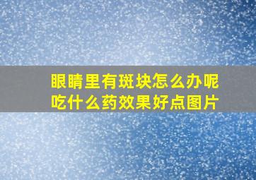 眼睛里有斑块怎么办呢吃什么药效果好点图片