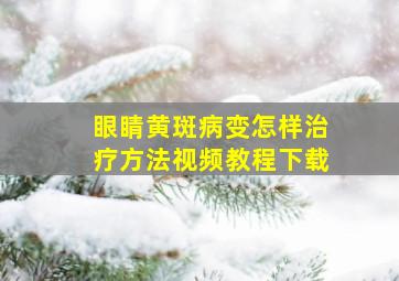 眼睛黄斑病变怎样治疗方法视频教程下载