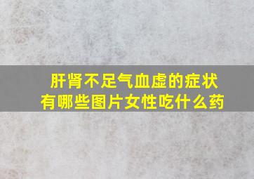 肝肾不足气血虚的症状有哪些图片女性吃什么药