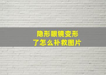 隐形眼镜变形了怎么补救图片