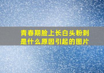 青春期脸上长白头粉刺是什么原因引起的图片